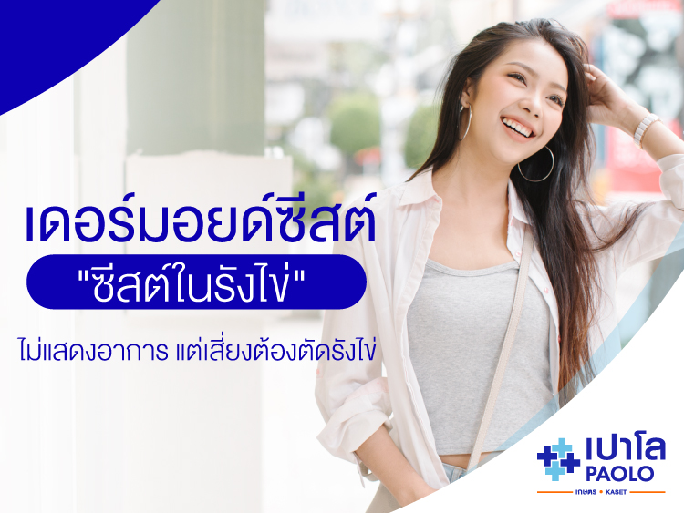 เดอร์มอยด์ซีสต์  ซีสต์ในรังไข่ที่ไม่แสดงอาการ แต่เสี่ยงต้องตัดรังไข่